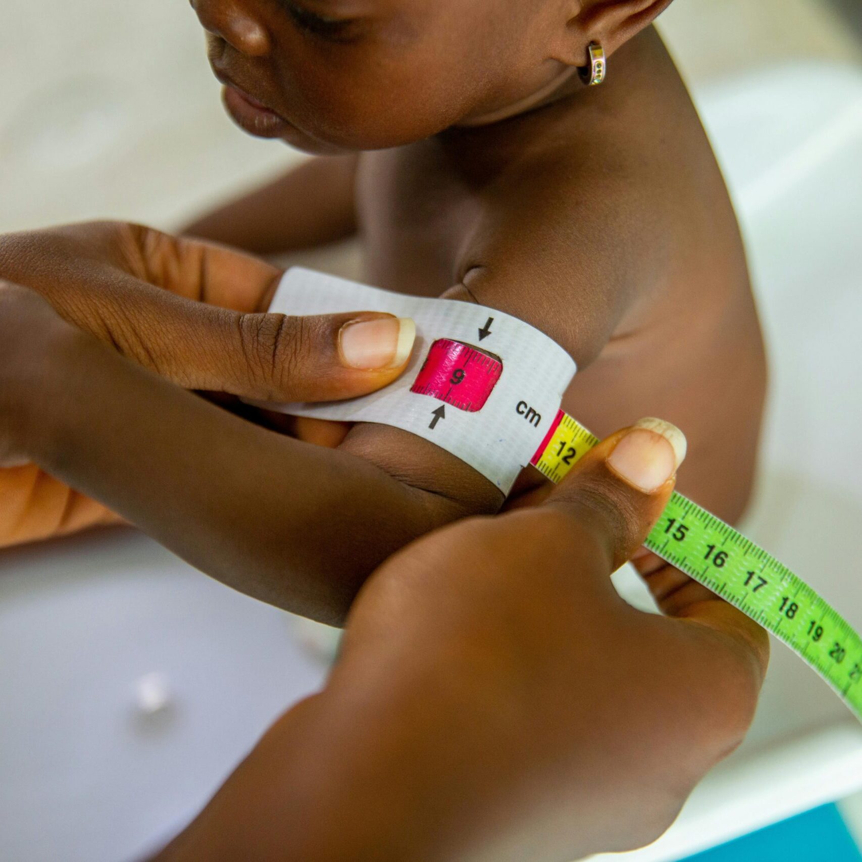 A healthcare professional measures a child's arm using MUAC tape for malnutrition assessment.